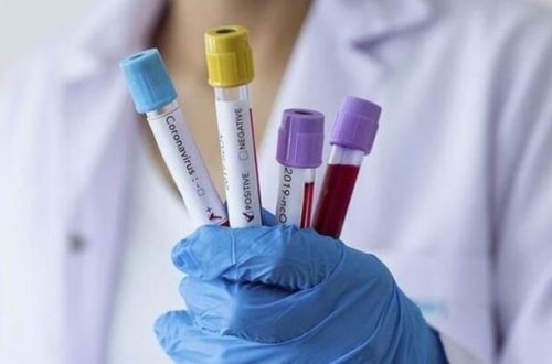 Bu xəstəlikdən əziyyət çəkənlərin virusa yoluxma riski 2-3 dəfə artacaq - XƏBƏRDARLIQ