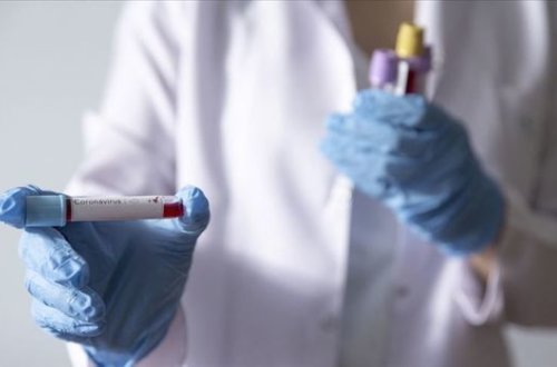 Azərbaycanda daha bir nəfər koronavirusdan öldü - 50 yeni yoluxma