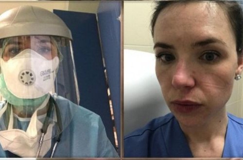 Врач из Италии: Мы выбирали тех, у кого больше шансов выжить -ИНТЕРВЬЮ