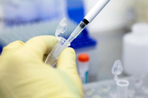 Azərbaycanda 49 nəfər virusa yoluxub, 62 nəfər müalicə olunaraq sağalıb - RƏSMİ