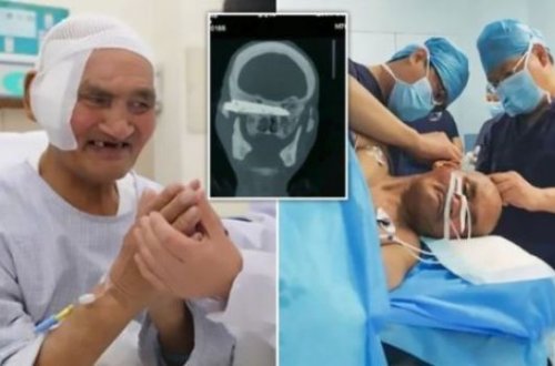 26 ildir başında ilişmiş bıçaq çıxarıldı - Şok əməliyyat