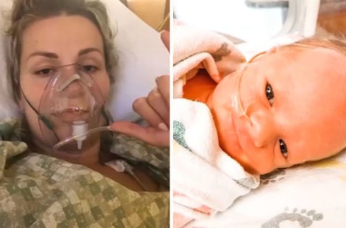 Зараженная коронавирусом женщина родила в состоянии комы