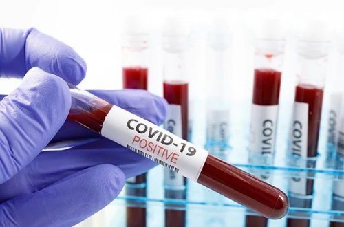 Ölüdən koronavirusa yoluxdu - Dünyada İLK