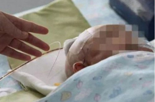 11 yaşlı qızın eyvandan atdığı alma üç aylıq körpəni komaya saldı