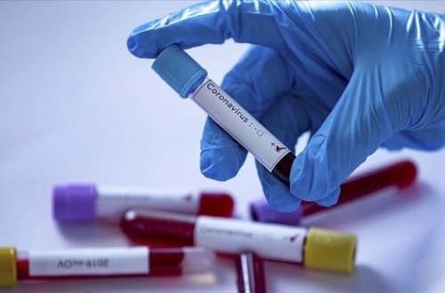 Azərbaycanda daha iki nəfər koronavirusdan öldü, 30 yeni yoluxma aşkarlandı - RƏSMİ