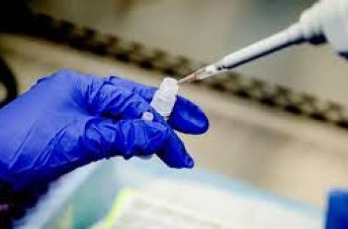 Koronavirus daha 4 orqanı sıradan çıxarır