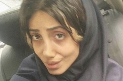 Özünü Ancelinaya oxşadan iranlı qız da koronavirusa yoluxdu - FOTO