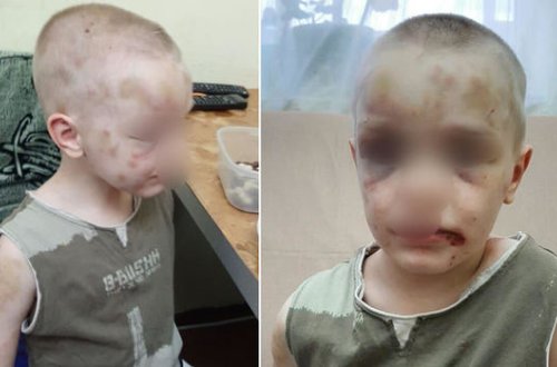 Rusiyada ana azyaşlı oğluna işgəncə verib