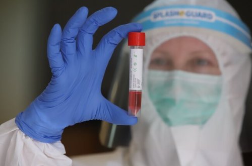 Azərbaycanda daha 38 nəfər koronavirusa yoluxub, 42 nəfər sağalıb