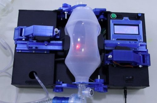 Азербайджанские инженеры разработали аппарат ИВЛ – ВИДЕО