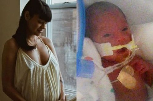 Koronavirusa yoluxduğu üçün komada olan qadın sağlam uşaq dünyaya gətirdi - FOTO