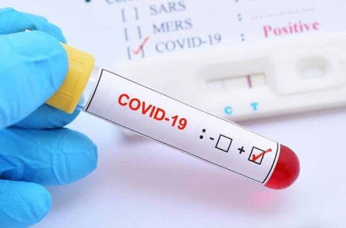 Son 24 saatda ölkədə neçə nəfər koronavirusa yoluxub? (RƏSMİ)