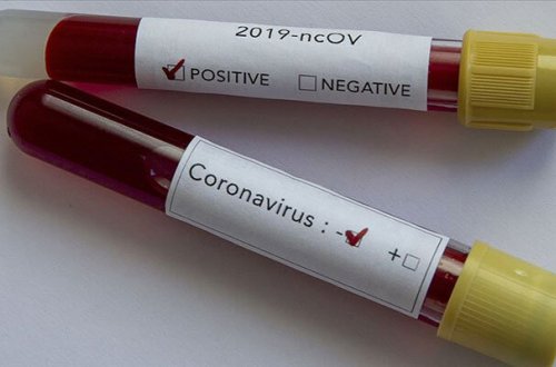 Azərbaycanda daha 30 nəfərdə koronavirus aşkarlandı - 41-i sağaldı