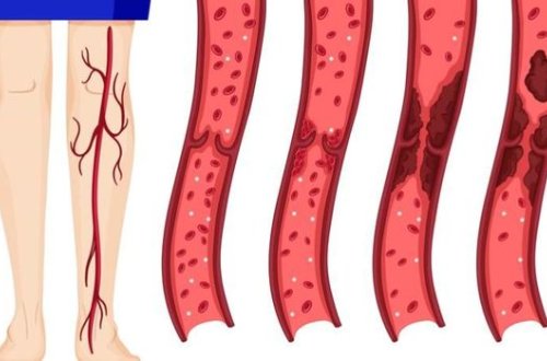 Выявлено новое осложнение коронавируса