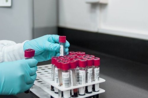 В Азербайджане от COVID-19 вылечились еще 65 человек - ОФИЦИАЛЬНО