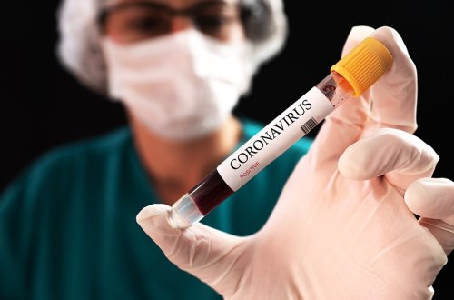 SON DƏQİQƏ! Azərbaycanın 12 rayonunda koronavirus  bitdi  -RƏSMİ