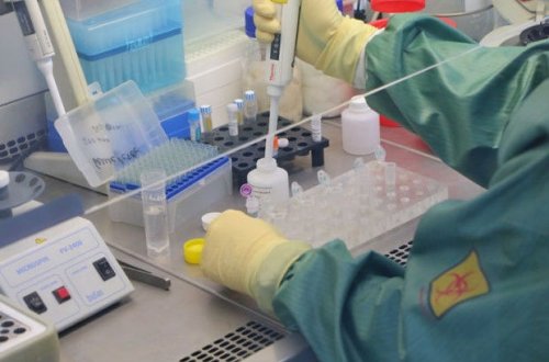 Azərbaycanda koronavirusa daha 28 yoluxma qeydə alındı, 59 nəfər sağaldı - VİDEO