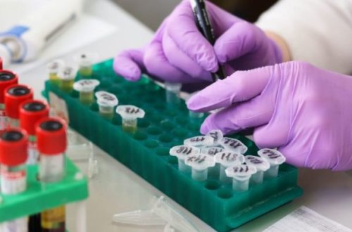 Azərbaycanda koronavirusa yoluxanların STATİSTİKASI