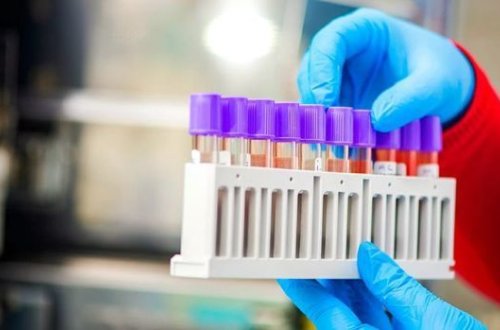 Azərbaycanda daha 23 nəfər koronavirusdan sağaldı - RƏSMİ