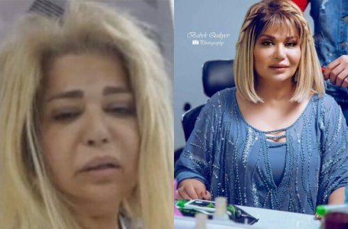 Plastik əməliyyat etdirdiyini gizlətmək istədi alınmadı - Video