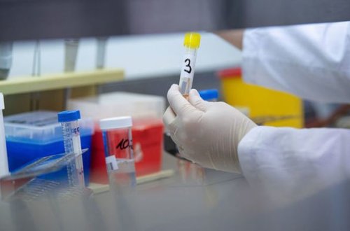 В Азербайджане выявлено 39 новых случаев инфицирования COVID-19 – ОФИЦИАЛЬНО