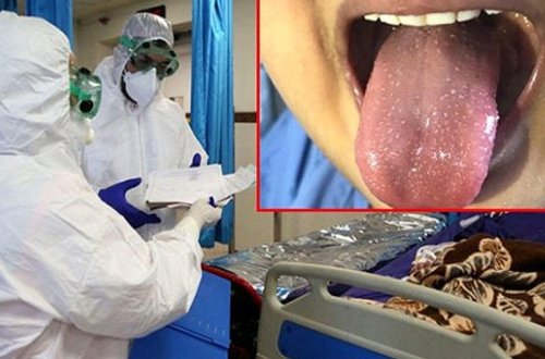 İngiltərədə daha bir dəhşətli xəstəlik ortaya ÇIXDI