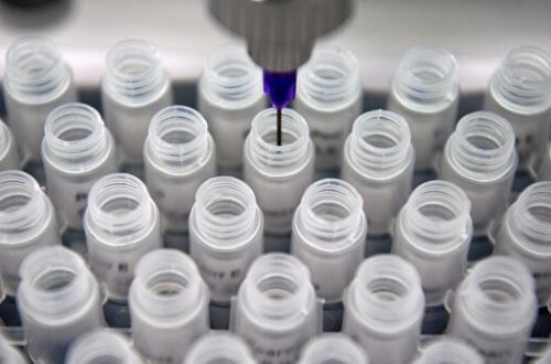 Alimlər qocalığa qarşı peyvənd hazırlamağı düşünürlər