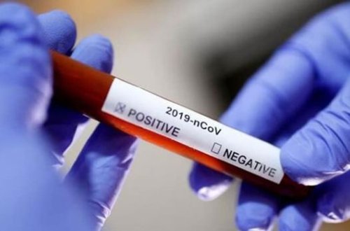 Bu dərmanlar COVID-19-un ilkin mərhələsində effektivdir