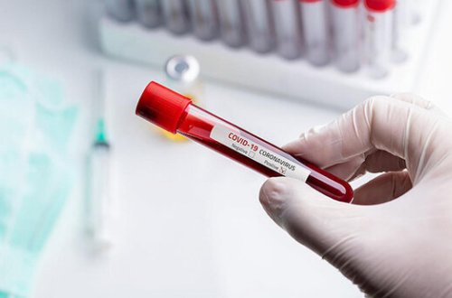 Azərbaycanda daha 49 nəfərdə koronavirus aşkarlandı - 46 nəfər sağaldı