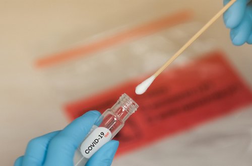 Azərbaycanda daha 38 nəfərdə koronavirus aşkarlandı - 1 nəfər vəfat etdi, 58-i sağaldı