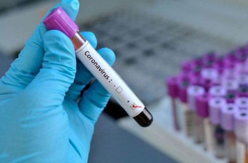 Azərbaycanda daha 38 nəfərdə koronavirus aşkarlanıb, 30 nəfər sağalıb