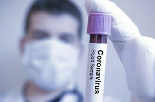 Türkiyə koronavirus daşıyıcılarını bu üsulla tapacaq