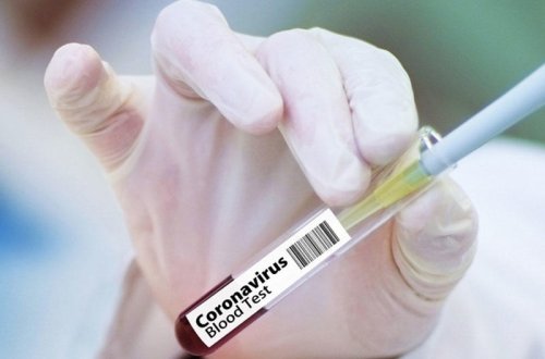 Daha 52 nəfərdə koronavirus tapıldı - 1 nəfər vəfat etdi, 39 nəfər sağaldı