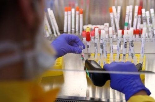 ABŞ-ın koronavirusun mənşəyi ilə bağlı iddialarına ÜST-dən cavab gəldi