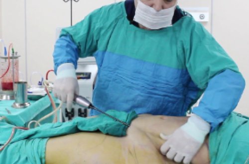 Bakıda ŞOK OLAY - Həkim qadına hamilə olduğunu deməyib onu əməliyyat etdi - FOTO