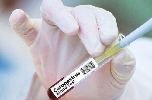 Azərbaycanda daha 67 nəfərdə koronavirus aşkarlandı - 2 nəfər vəfat etdi, 28-i sağaldı
