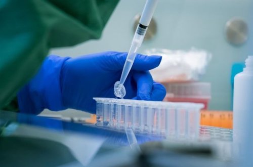 Böyük Britaniyada koronavirus xəstələrinin sayı 200 mini keçdi
