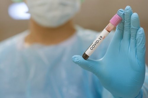 Azərbaycanda daha 77 nəfər koronavirusa yoluxdu, 15 nəfər sağaldı