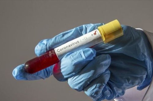 Число зараженных коронавирусом в Армении достигло 3 392