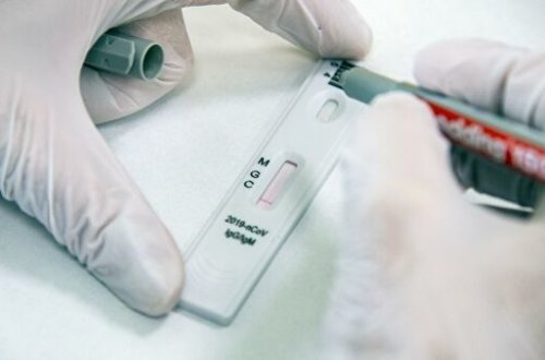 Hindistan koronavirus üçün antikor testi hazırladı