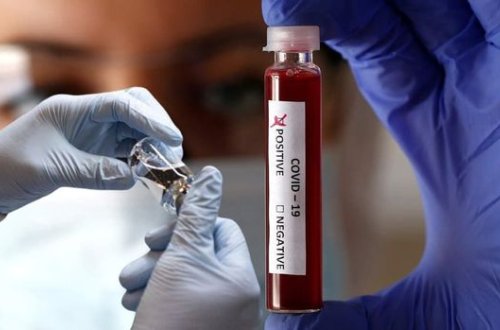 D vitamini koronavirusdan ölüm nisbətini azaldır