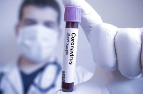 В Азербайджане выявлено 65 новых случаев инфицирования COVID-19, два человека скончались - ОФИЦИАЛЬНО