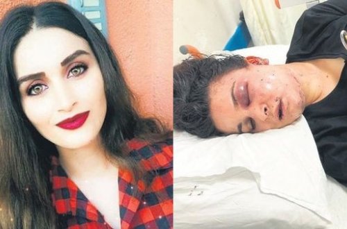 Arvadını stula bağlayıb, saatlarla işgəncə verdi - FOTO/VİDEO