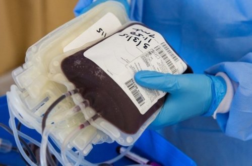 В Азербайджане больным коронавирусом трансплантирована иммунная плазма