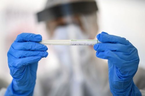 Azərbaycanda nazirliyin 15 əməkdaşında koronavirus aşkarlandı - RƏSMİ AÇIQLAMA