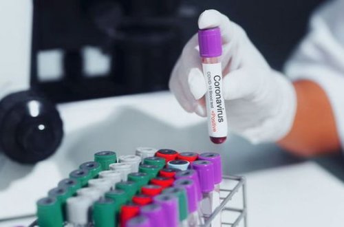 Koronavirusla bağlı son STATİSTİKA