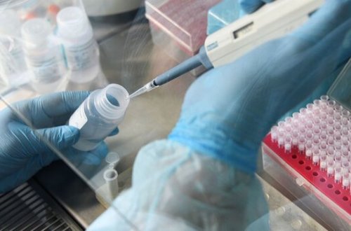 В Азербайджане выявлено 158 новых случаев инфицирования COVID-19