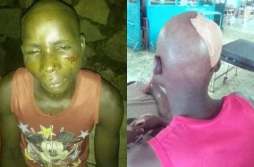 Tələbəni oğurlayıb, diri-diri dəfn etmək istədilər - FOTO