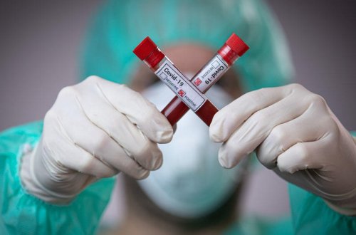 В Азербайджане выявлено 113 новых случаев инфицирования COVID-19, один человек скончался