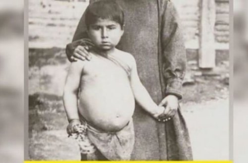 Bu uşağın hazırda hansı məşhur müğənnimiz olduğunu bilənlər TƏƏCÜBLƏNDİ - FOTO